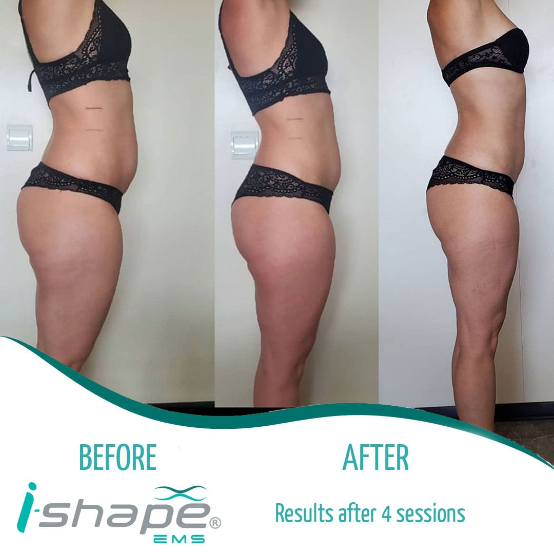 i-Shape