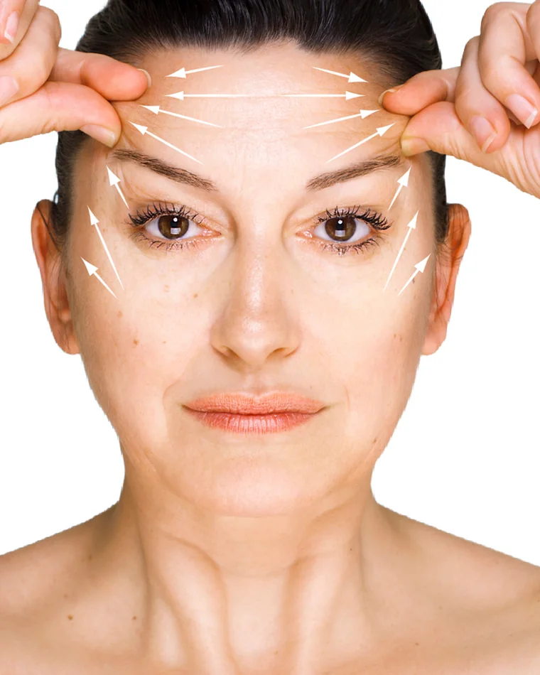 Brow Lift — Ανόρθωση Φρυδίων